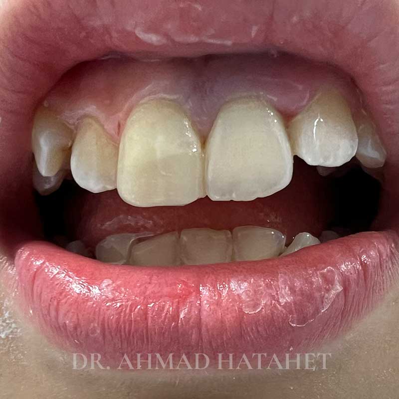 After dental treatment case 2