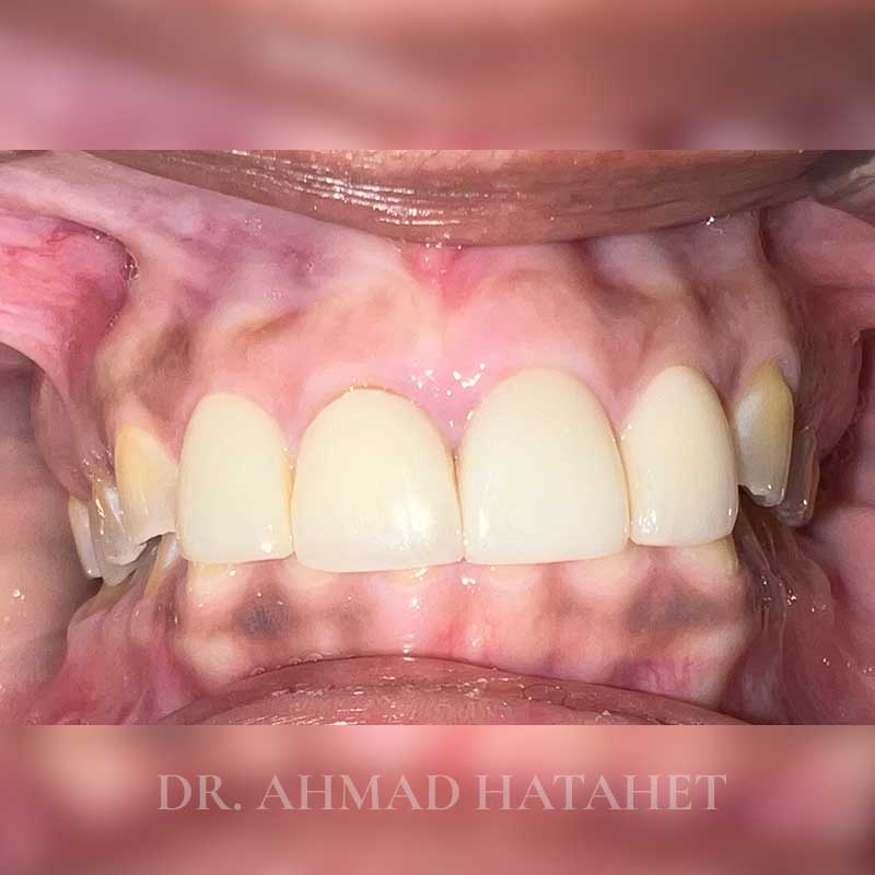 Before dental treatment case 3