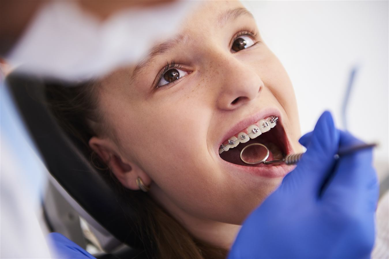 Orthodontics at Caring Dental of Herndon